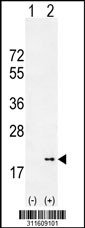 Western blot analysis of his-tag FAU (arrow) using his tag antibody. 293 cell lysates (2 ug/lane) either nontransfected (Lane 1) or transiently transfected with the FAU gene