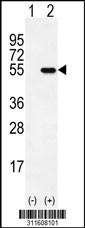 Western blot analysis of his-tag DEK (arrow) using his tag antibody. 293 cell lysates (2 ug/lane) either nontransfected (Lane 1) or transiently transfected with the DEK gene