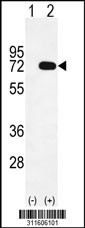 Western blot analysis of his-tag CTPS2 (arrow) using his tag antibody. 293 cell lysates (2 ug/lane) either nontransfected (Lane 1) or transiently transfected with the CTPS2 gene