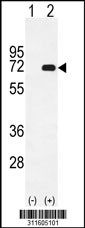 Western blot analysis of his-tag CRY1 (arrow) using his tag antibody. 293 cell lysates (2 ug/lane) either nontransfected (Lane 1) or transiently transfected with the CRY1 gene