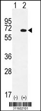 Western blot analysis of his-tag ZFP37 (arrow) using his tag antibody. 293 cell lysates (2 ug/lane) either nontransfected (Lane 1) or transiently transfected with the ZFP37 gene