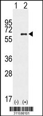 Western blot analysis of his-tag RNF213 (arrow) using his tag antibody. 293 cell lysates (2 ug/lane) either nontransfected (Lane 1) or transiently transfected with the RNF213 gene