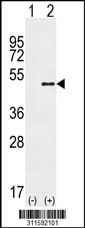 Western blot analysis of his-tag MYLIP (arrow) using his tag antibody. 293 cell lysates (2 ug/lane) either nontransfected (Lane 1) or transiently transfected with the MYLIP gene