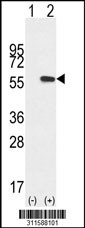 Western blot analysis of his-tag INTS4 (arrow) using his tag antibody. 293 cell lysates (2 ug/lane) either nontransfected (Lane 1) or transiently transfected with the INTS4 gene