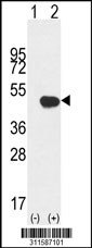 Western blot analysis of his-tag IDH1 (arrow) using his tag antibody. 293 cell lysates (2 ug/lane) either nontransfected (Lane 1) or transiently transfected with the IDH1 gene