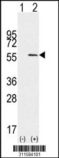 Western blot analysis of his-tag CYP4X1 (arrow) using his tag antibody. 293 cell lysates (2 ug/lane) either nontransfected (Lane 1) or transiently transfected with the CYP4X1 gene