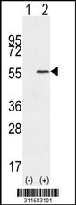 Western blot analysis of his-tag CYP1B1 (arrow) using his tag antibody. 293 cell lysates (2 ug/lane) either nontransfected (Lane 1) or transiently transfected with the CYP1B1 gene