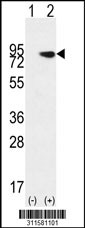 Western blot analysis of his-tag CALD1 (arrow) using his tag antibody. 293 cell lysates (2 ug/lane) either nontransfected (Lane 1) or transiently transfected with the CALD1 gene