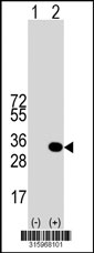Western blot analysis of his-tag PNPLA4 (arrow) using his tag antibody. 293T cell lysates (2 ug/lane) either nontransfected (Lane 1) or transiently transfected with the PNPLA4 gene‘