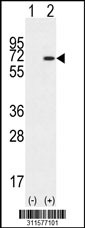 Western blot analysis of his-tag SYNCRIP (arrow) using his tag antibody. 293 cell lysates (2 ug/lane) either nontransfected (Lane 1) or transiently transfected with the SYNCRIP gene
