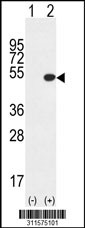 Western blot analysis of his-tag PRAME (arrow) using his tag antibody. 293 cell lysates (2 ug/lane) either nontransfected (Lane 1) or transiently transfected with the PRAME gene