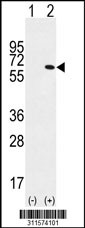 Western blot analysis of his-tag P4HA2 (arrow) using his tag antibody. 293 cell lysates (2 ug/lane) either nontransfected (Lane 1) or transiently transfected with the P4HA2 gene
