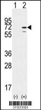 Western blot analysis of his-tag NOP5/NOP58 (arrow) using his tag antibody. 293 cell lysates (2 ug/lane) either nontransfected (Lane 1) or transiently transfected with the NOP5/NOP58 gene