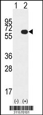 Western blot analysis of his-tag HEXA (arrow) using his tag antibody. 293 cell lysates (2 ug/lane) either nontransfected (Lane 1) or transiently transfected with the HEXA gene