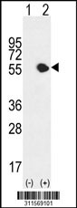 Western blot analysis of his-tag FMO3 (arrow) using his tag antibody. 293 cell lysates (2 ug/lane) either nontransfected (Lane 1) or transiently transfected with the FMO3 gene