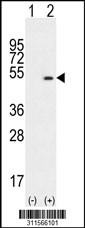 Western blot analysis of his-tag CYP51A1 (arrow) using his tag antibody. 293 cell lysates (2 ug/lane) either nontransfected (Lane 1) or transiently transfected with the CYP51A1 gene