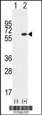Western blot analysis of his-tag CYP4F12 (arrow) using his tag antibody. 293 cell lysates (2 ug/lane) either nontransfected (Lane 1) or transiently transfected with the CYP4F12 gene