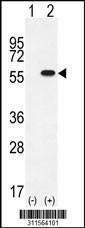 Western blot analysis of his-tag CYP1A1 (arrow) using his tag antibody. 293 cell lysates (2 ug/lane) either nontransfected (Lane 1) or transiently transfected with the CYP1A1 gene