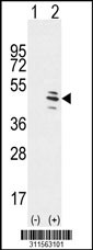 Western blot analysis of his-tag CYP11A1 (arrow) using his tag antibody. 293 cell lysates (2 ug/lane) either nontransfected (Lane 1) or transiently transfected with the CYP11A1 gene