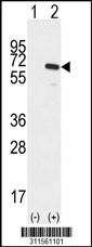 Western blot analysis of his-tag ATP5B (arrow) using his tag antibody. 293 cell lysates (2 ug/lane) either nontransfected (Lane 1) or transiently transfected with the ATP5B gene