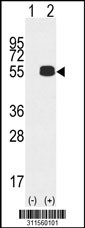 Western blot analysis of his-tag ATP5B (arrow) using his tag antibody. 293 cell lysates (2 ug/lane) either nontransfected (Lane 1) or transiently transfected with the ATP5B gene