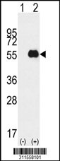 Western blot analysis of his-tag TRAF2 (arrow) using his tag antibody. 293 cell lysates (2 ug/lane) either nontransfected (Lane 1) or transiently transfected with the TRAF2 gene