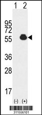 Western blot analysis of his-tag PDHX (arrow) using his tag antibody. 293 cell lysates (2 ug/lane) either nontransfected (Lane 1) or transiently transfected with the PDHX gene