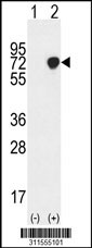 Western blot analysis of his-tag MEF2A (arrow) using his tag antibody. 293 cell lysates (2 ug/lane) either nontransfected (Lane 1) or transiently transfected with the MEF2A gene