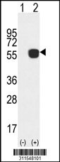 Western blot analysis of his-tag ARSA (arrow) using his tag antibody. 293 cell lysates (2 ug/lane) either nontransfected (Lane 1) or transiently transfected with the ARSA gene