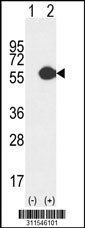Western blot analysis of his-tag ALDH1L1 (arrow) using his tag antibody. 293 cell lysates (2 ug/lane) either nontransfected (Lane 1) or transiently transfected with the ALDH1L1 gene