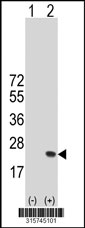 Western blot analysis of his-tag DNAJC24 (arrow) using his tag antibody. 293T cell lysates (2 ug/lane) either nontransfected (Lane 1) or transiently transfected with the DNAJC24 gene‘