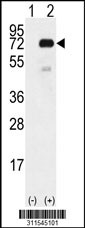 Western blot analysis of his-tag ACBD5 (arrow) using his tag antibody. 293 cell lysates (2 ug/lane) either nontransfected (Lane 1) or transiently transfected with the ACBD5 gene