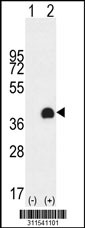 Western blot analysis of his-tag VEGFC (arrow) using his tag antibody. 293 cell lysates (2 ug/lane) either nontransfected (Lane 1) or transiently transfected with the VEGFC gene
