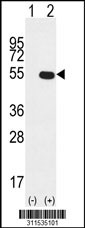 Western blot analysis of his-tag POLG2 (arrow) using his tag antibody. 293 cell lysates (2 ug/lane) either nontransfected (Lane 1) or transiently transfected with the POLG2 gene