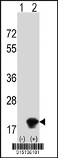 Western blot analysis of his-tag CDK2AP2 (arrow) using his tag antibody. 293T cell lysates (2 ug/lane) either nontransfected (Lane 1) or transiently transfected with the CDK2AP2 gene‘