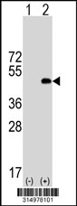 Western blot analysis of his-tag TUBE1 (arrow) using his tag antibody. 293T cell lysates (2 ug/lane) either nontransfected (Lane 1) or transiently transfected with the TUBE1 gene‘