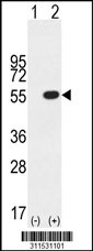 Western blot analysis of his-tag MGC42105 (arrow) using his tag antibody. 293 cell lysates (2 ug/lane) either nontransfected (Lane 1) or transiently transfected with the MGC42105 gene