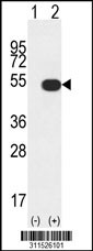 Western blot analysis of his-tag GSS (arrow) using his tag antibody. 293 cell lysates (2 ug/lane) either nontransfected (Lane 1) or transiently transfected with the GSS gene