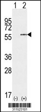 Western blot analysis of his-tag FYN (arrow) using his tag antibody. 293 cell lysates (2 ug/lane) either nontransfected (Lane 1) or transiently transfected with the FYN gene