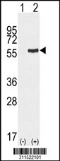 Western blot analysis of his-tag FMO2 (arrow) using his tag antibody. 293 cell lysates (2 ug/lane) either nontransfected (Lane 1) or transiently transfected with the FMO2 gene