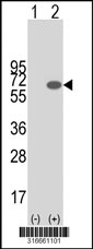 Western blot analysis of his-tag DYNC1LI1 (arrow) using his tag antibody. 293T cell lysates (2 ug/lane) either nontransfected (Lane 1) or transiently transfected with the DYNC1LI1 gene‘