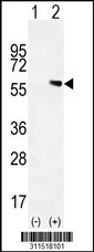 Western blot analysis of his-tag CDC25C (arrow) using his tag antibody. 293 cell lysates (2 ug/lane) either nontransfected (Lane 1) or transiently transfected with the CDC25C gene