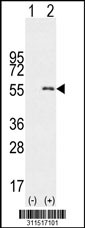 Western blot analysis of his-tag CD4 (arrow) using his tag antibody. 293 cell lysates (2 ug/lane) either nontransfected (Lane 1) or transiently transfected with the CD4 gene