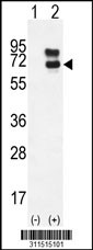 Western blot analysis of his-tag C19orf26 (arrow) using his tag antibody. 293 cell lysates (2 ug/lane) either nontransfected (Lane 1) or transiently transfected with the C19orf26 gene