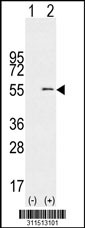 Western blot analysis of his-tag BPIL1 (arrow) using his tag antibody. 293 cell lysates (2 ug/lane) either nontransfected (Lane 1) or transiently transfected with the BPIL1 gene