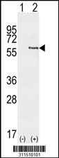 Western blot analysis of his-tag ALDH1A2 (arrow) using his tag antibody. 293 cell lysates (2 ug/lane) either nontransfected (Lane 1) or transiently transfected with the ALDH1A2 gene