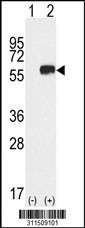 Western blot analysis of his-tag AGT (arrow) using his tag antibody. 293 cell lysates (2 ug/lane) either nontransfected (Lane 1) or transiently transfected with the AGT gene