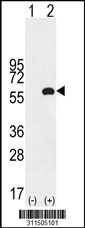 Western blot analysis of his-tag TUBB1 (arrow) using his tag antibody. 293 cell lysates (2 ug/lane) either nontransfected (Lane 1) or transiently transfected with the TUBB1 gene
