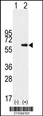 Western blot analysis of his-tag TUBB (arrow) using his tag antibody. 293 cell lysates (2 ug/lane) either nontransfected (Lane 1) or transiently transfected with the TUBB gene