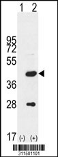 Western blot analysis of his-tag RFC4 (arrow) using his tag antibody. 293 cell lysates (2 ug/lane) either nontransfected (Lane 1) or transiently transfected with the RFC4 gene
